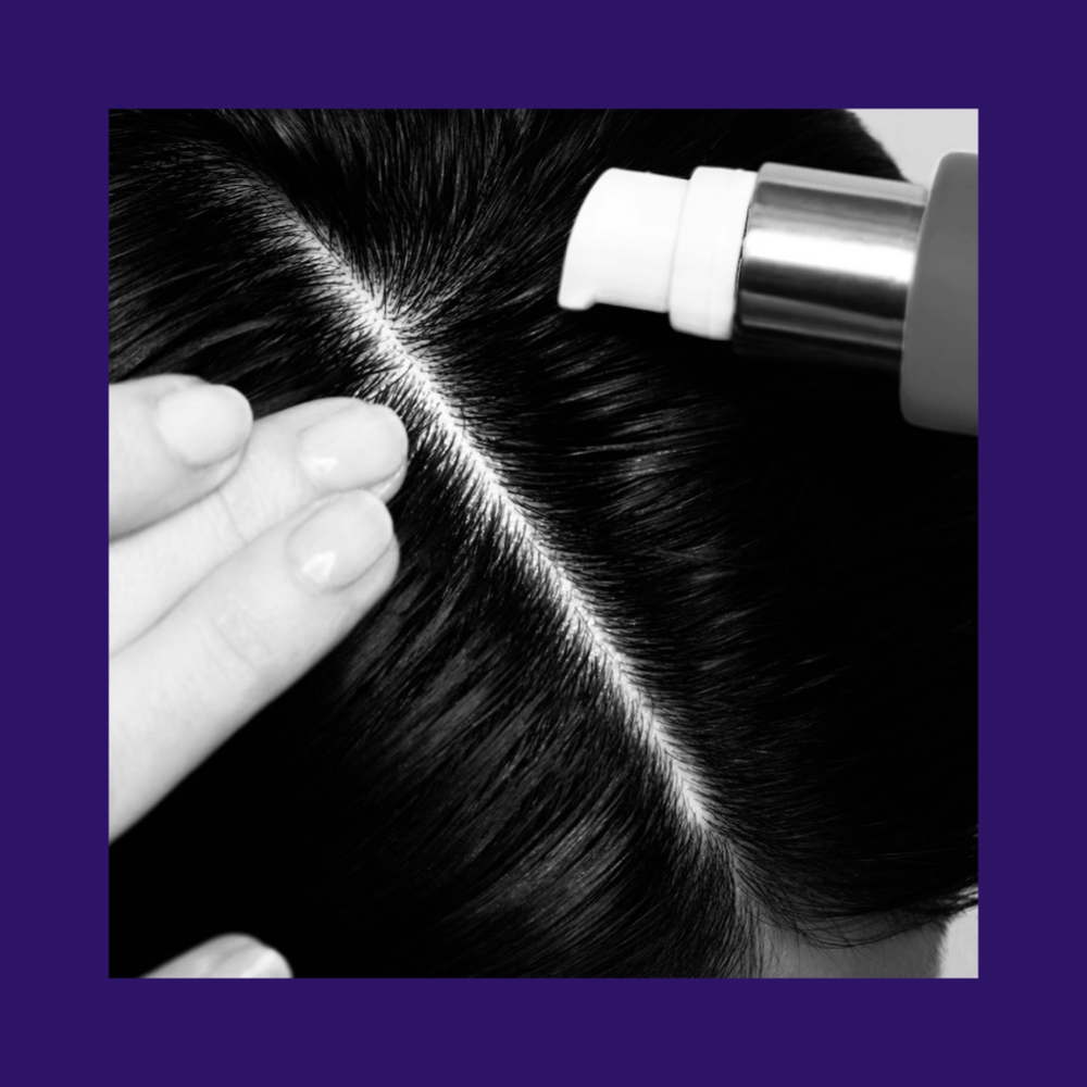 Scalp Treatment