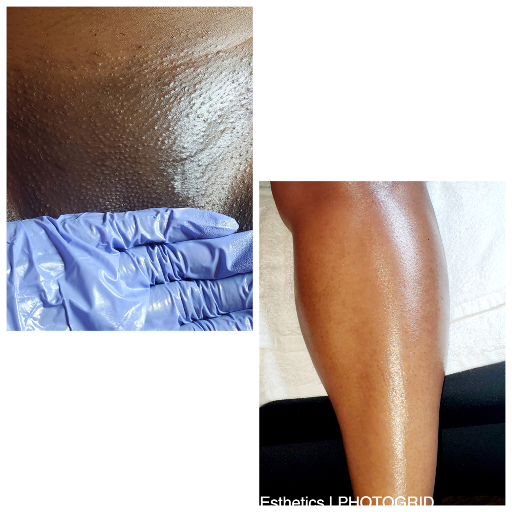 Brazilian & 1/2 Leg