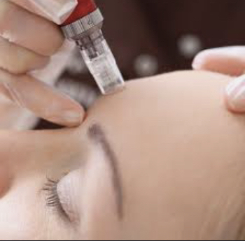 Microneedling facial at Glo Beauty studio llc in Phoenix, AZ
