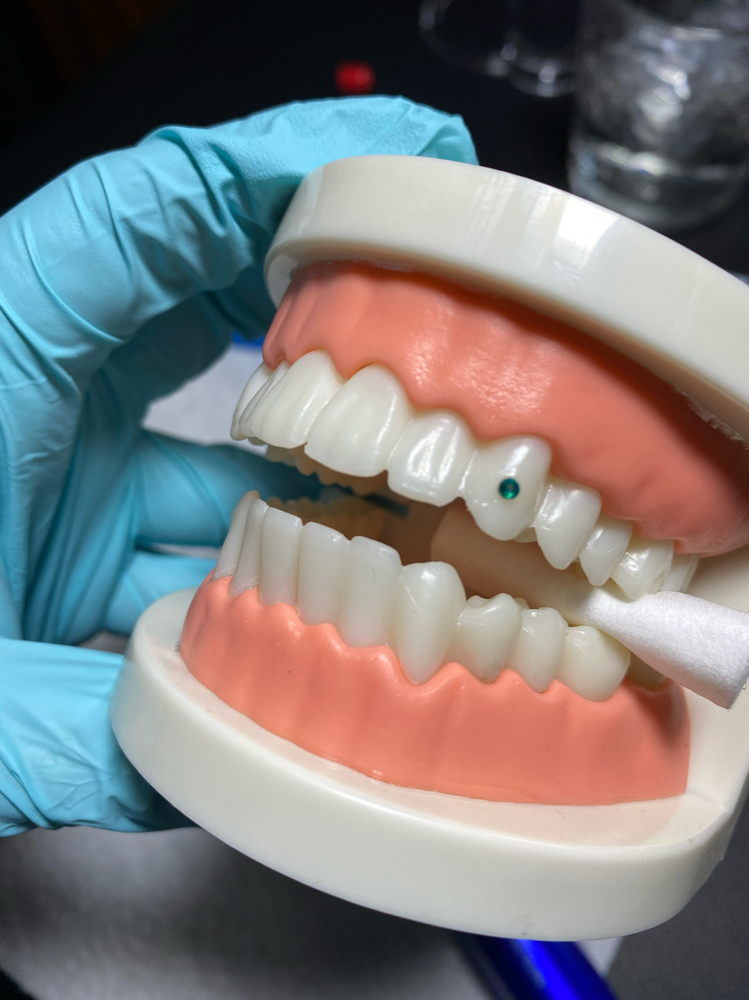 1 Tooth Gem