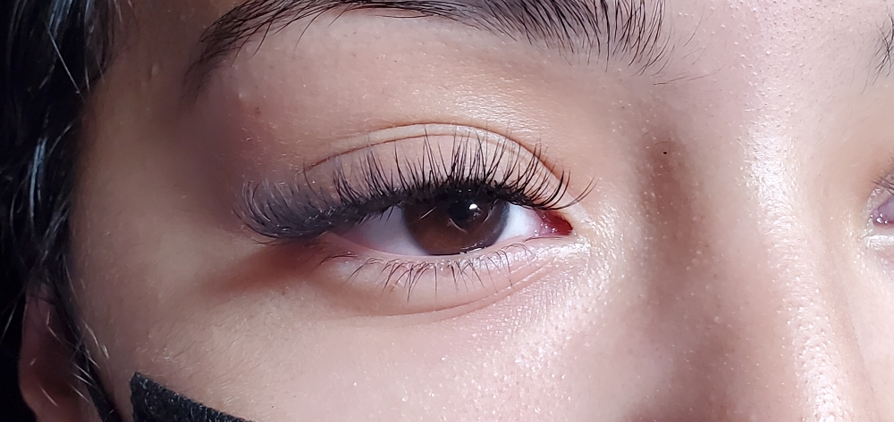 Fill (2 Weeks -5 Weeks)