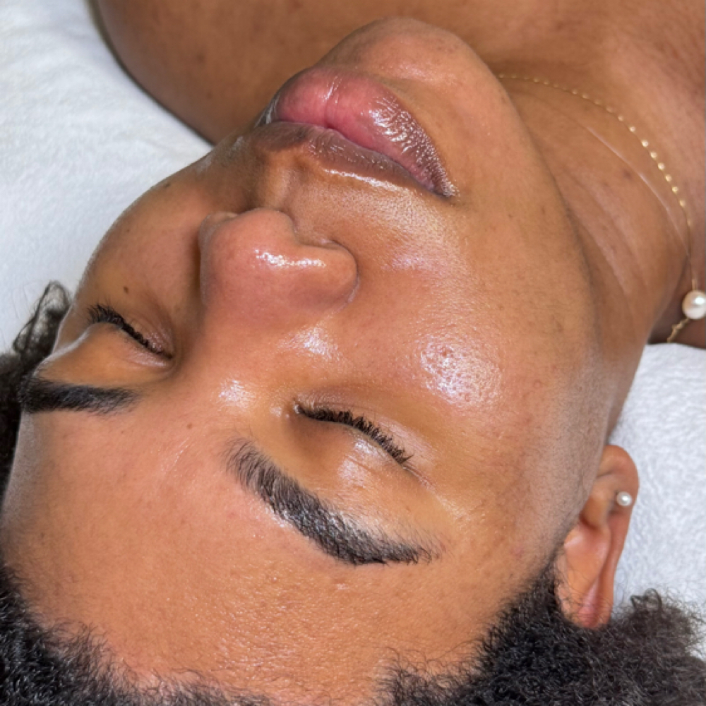 Salmon DNA Treatment at Taiane Alvarenga Concept in Woburn, MA