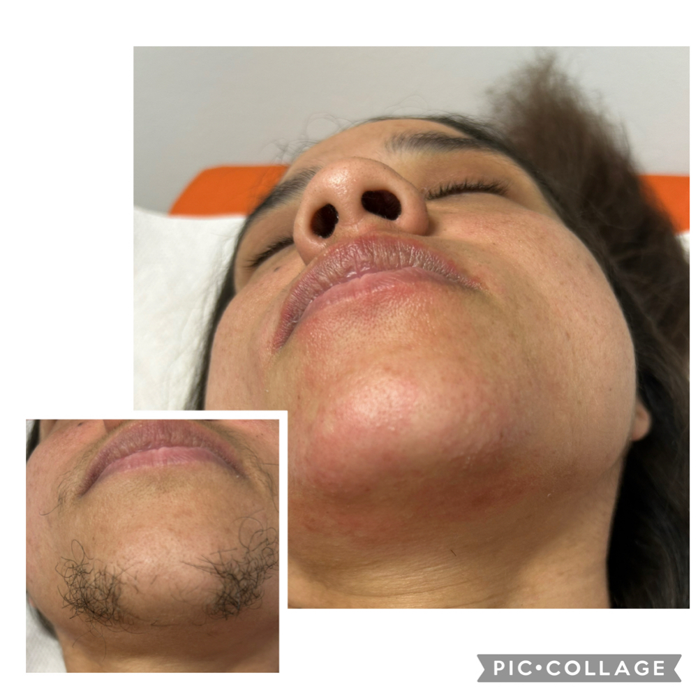 Chin Wax at Kayanna White in Murfreesboro, TN