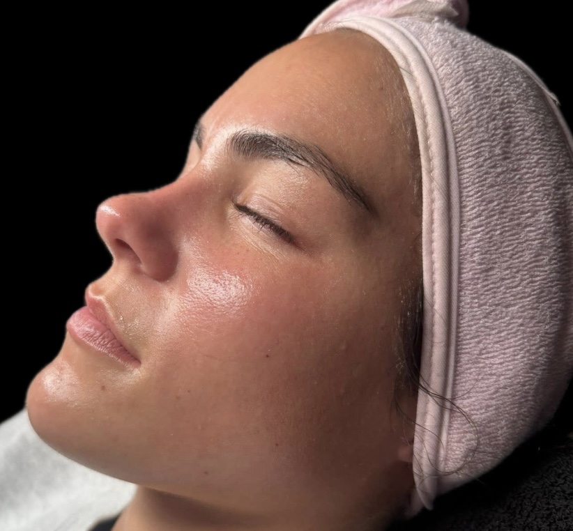 Dermaplane Facial