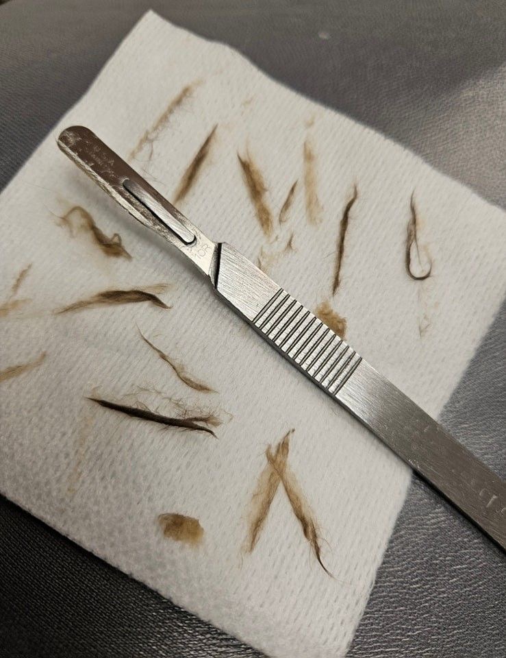 The Dermaplane Edit at Le Chic Aesthetics in Marrero, LA