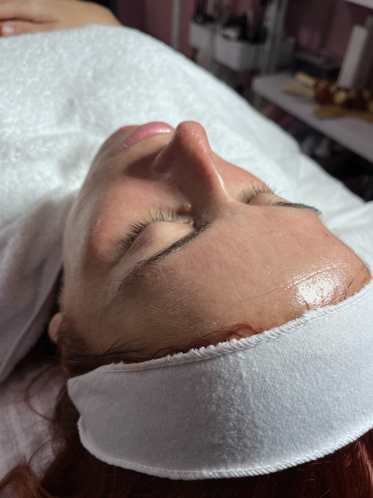 Hydration Facial Treatment