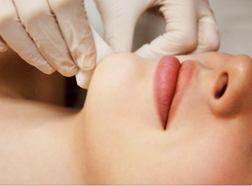 Waxing - Chin