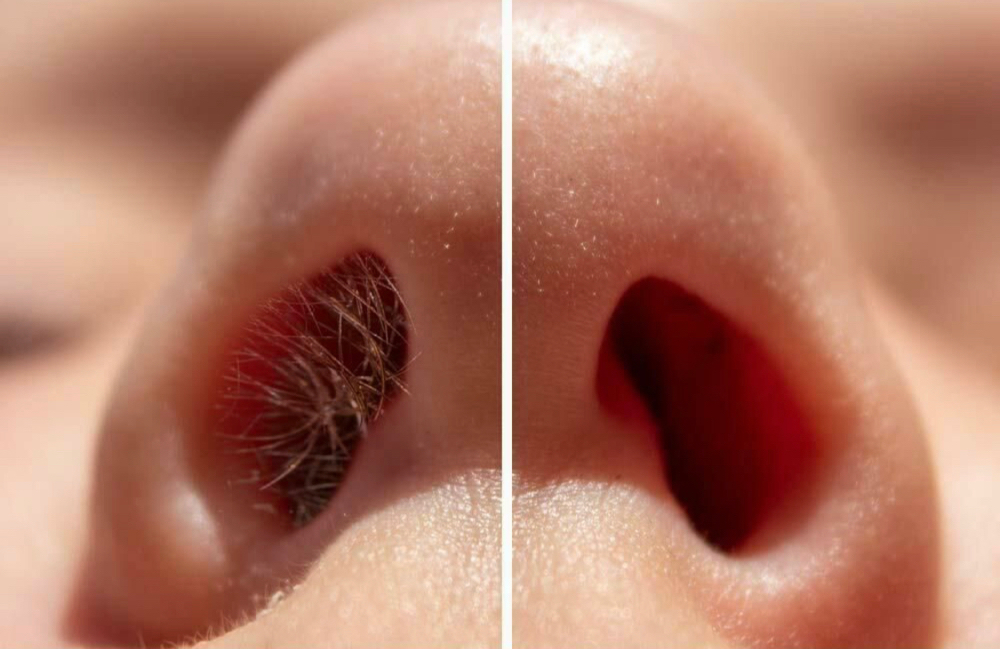 Waxing - Nostril