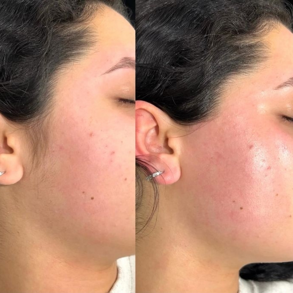 Sideburns at Bella Glow Skin and Body in San Antonio, TX