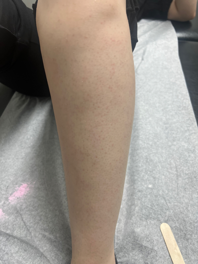Leg Wax - Full at Aesthetically You in Modesto, CA