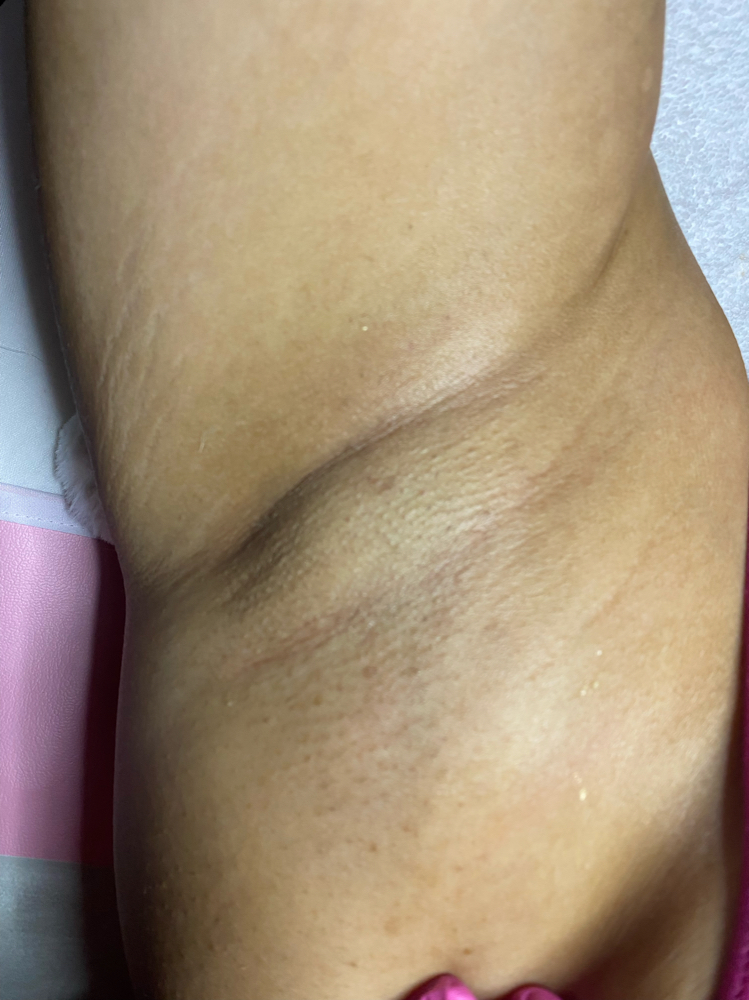 Armpit Wax