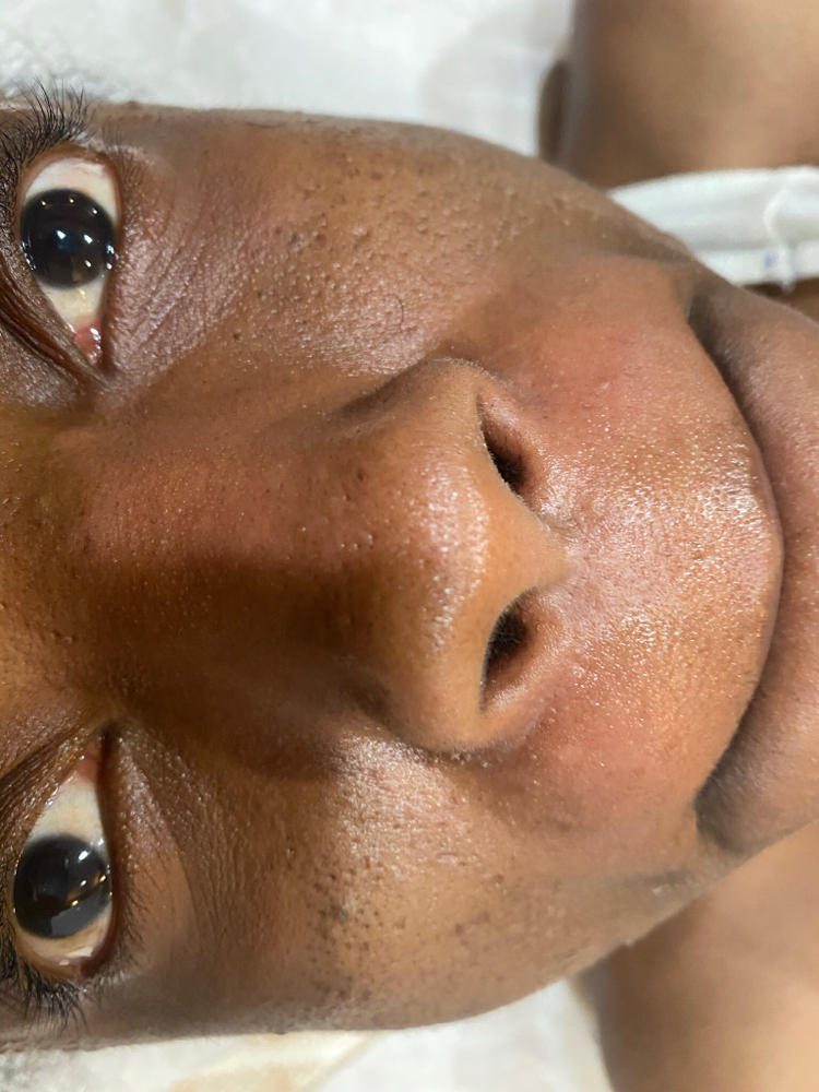 Lip/ Chin Wax