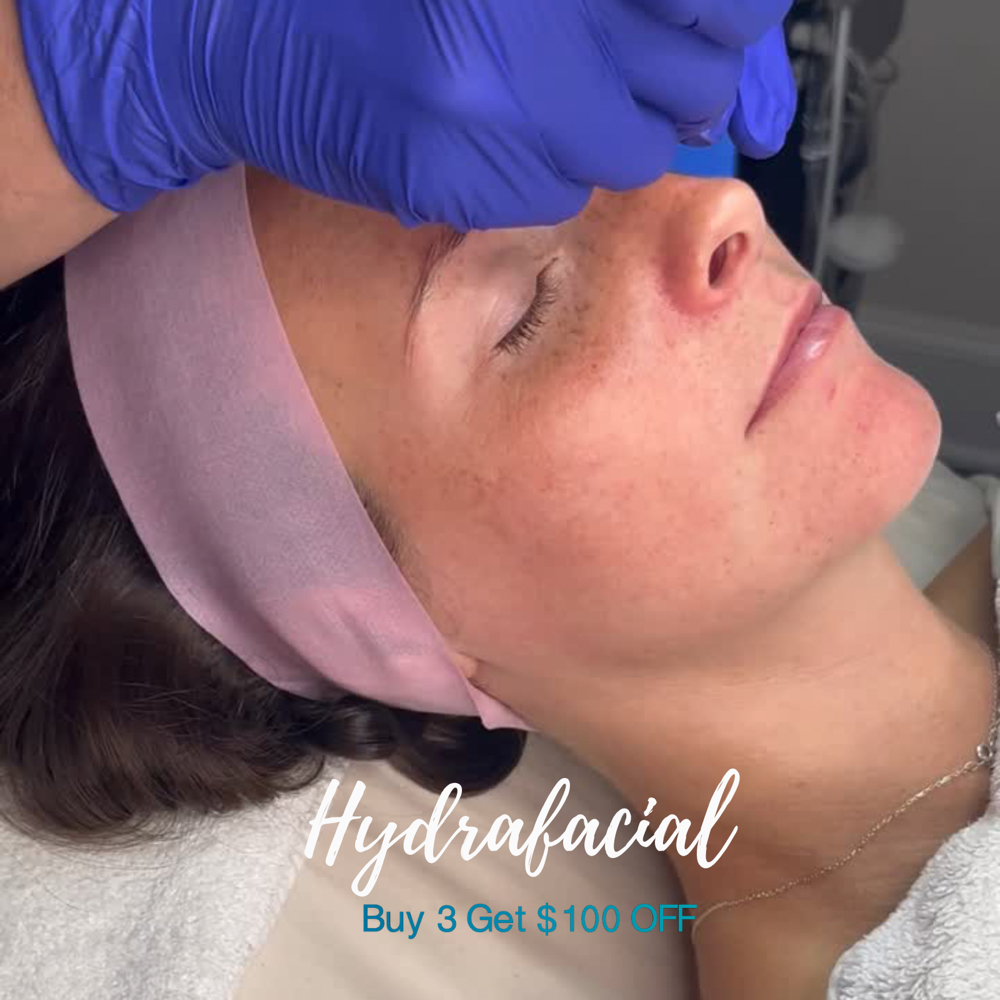 Buy 3 Hydrafacials Receive $100 Off at Skintology Apothecary in Tyler, TX