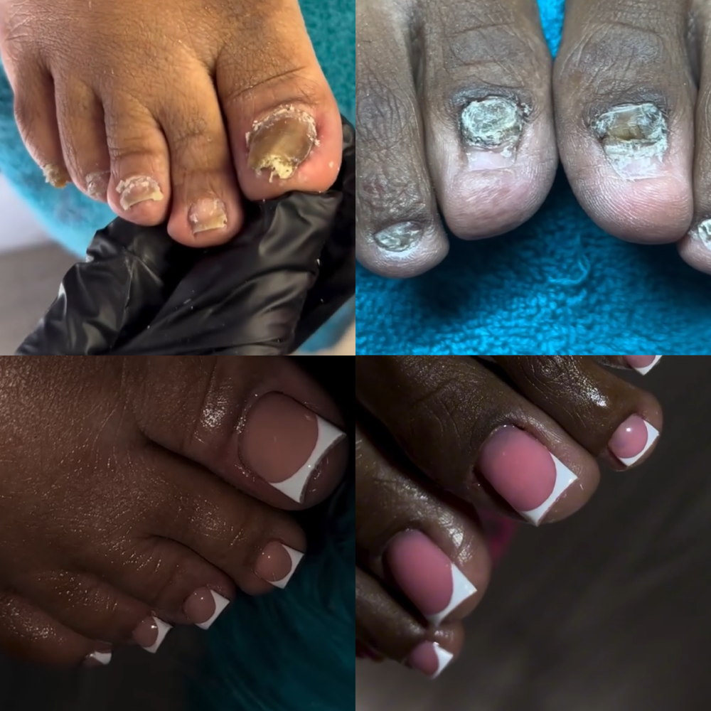 Elite Toe BBL at The Nail Vault in Marietta, GA