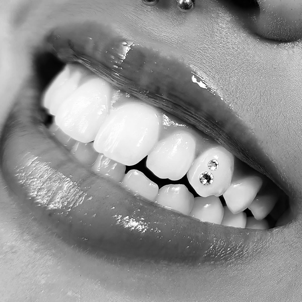 Tooth Gem