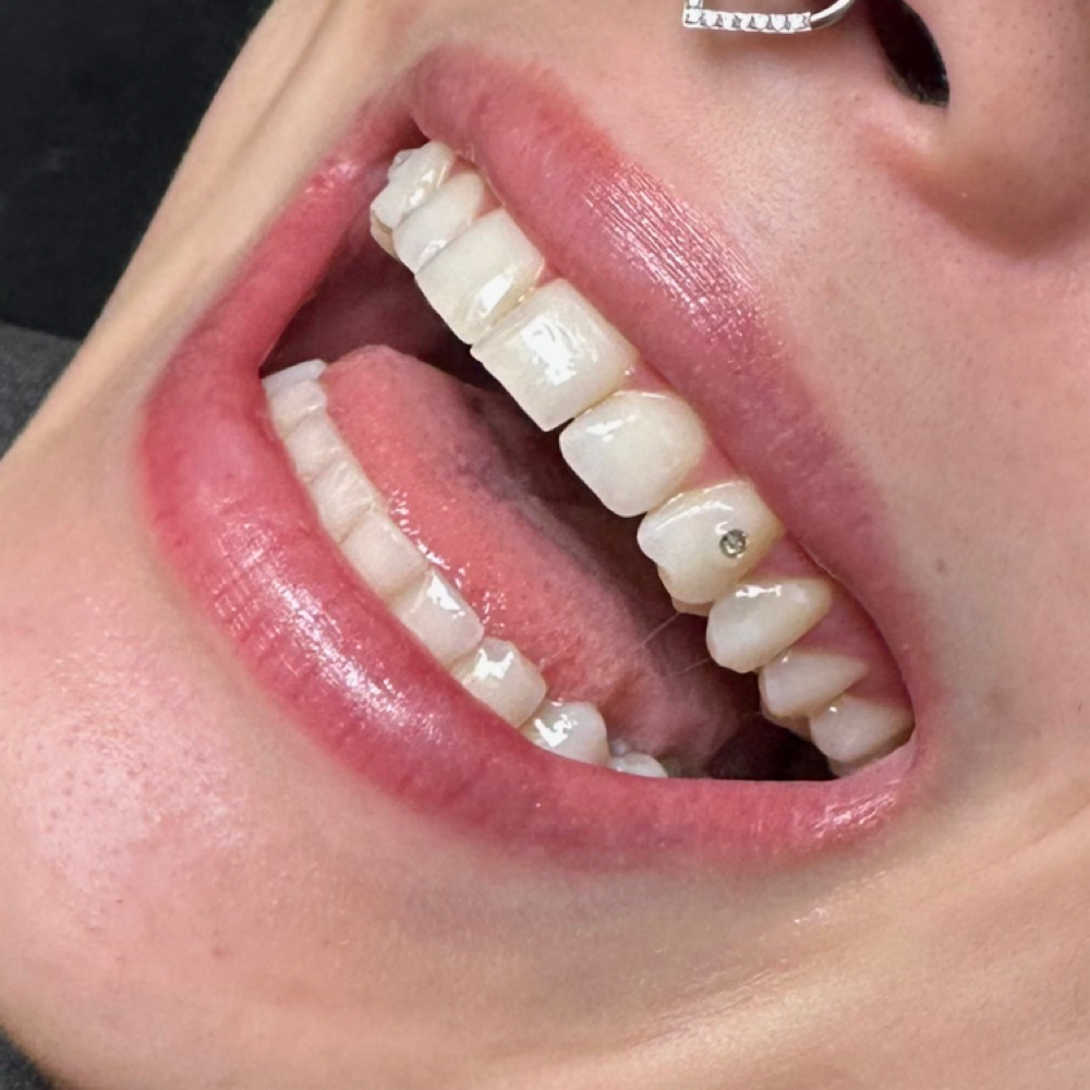 Tooth Gem at LEXIS LOX in Longview, WA