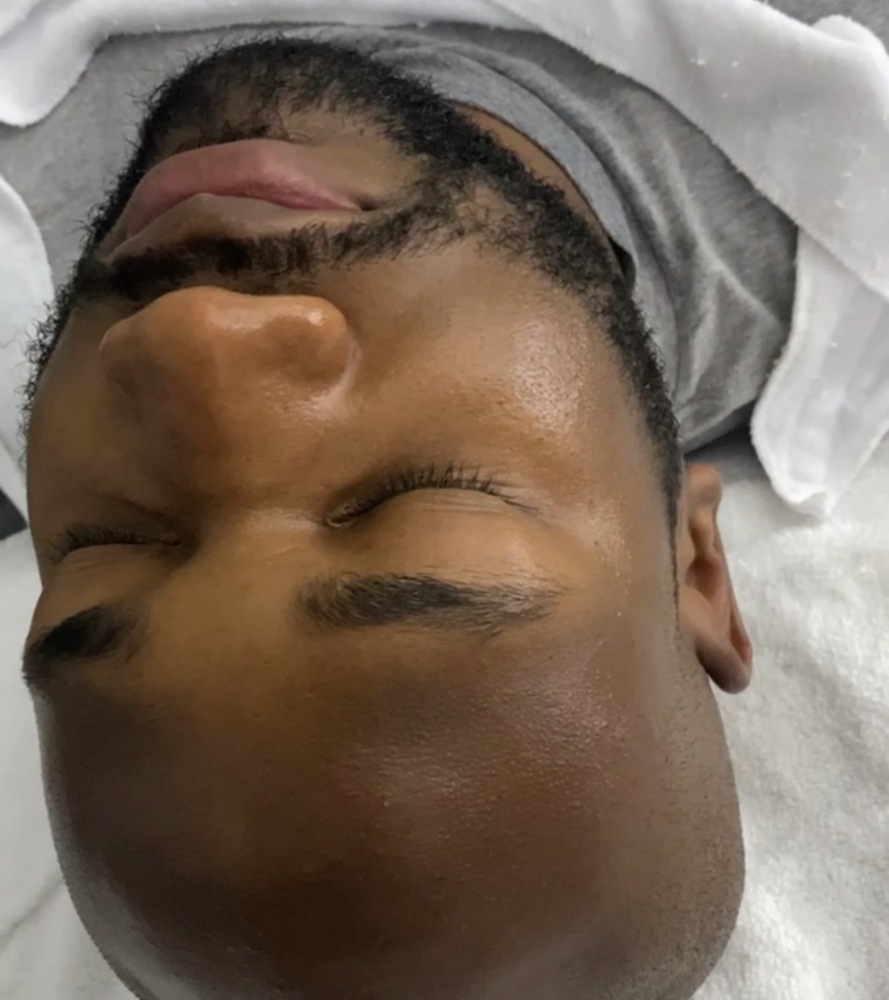 ADD ON : Beard Treatment