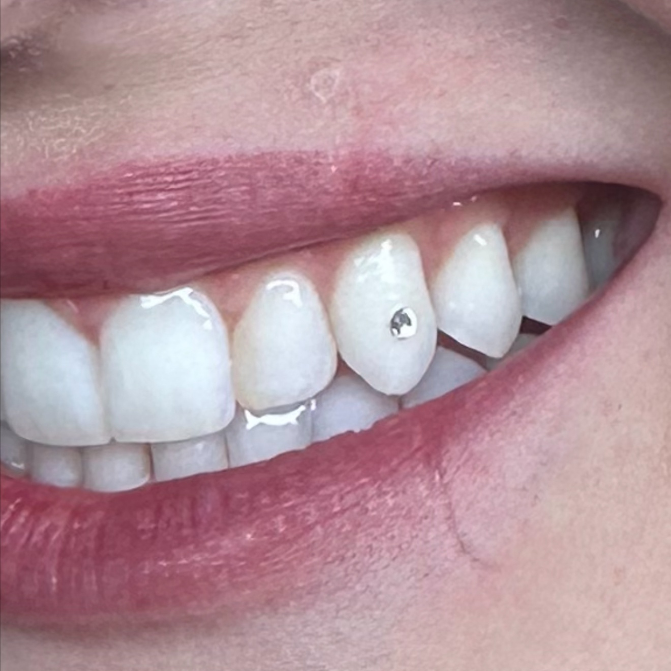 15 Min Tooth Gem Session