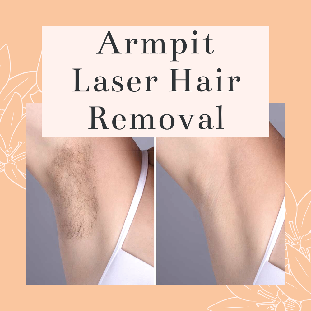 Laser Hair Removal-Underarm