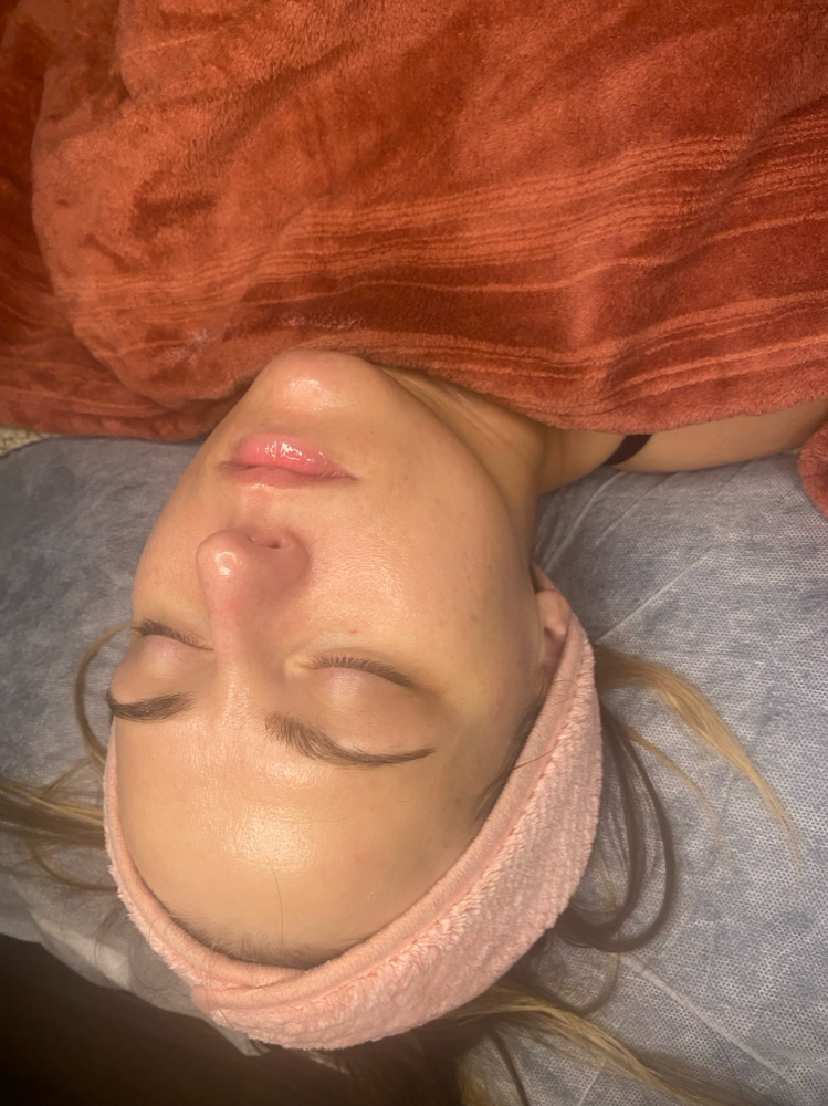 Dermaplane Facial