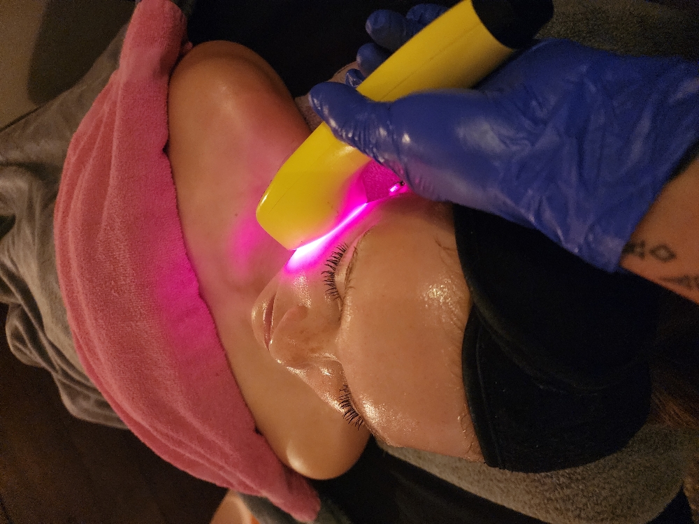 Dermaplaning Facial (+browshaping)