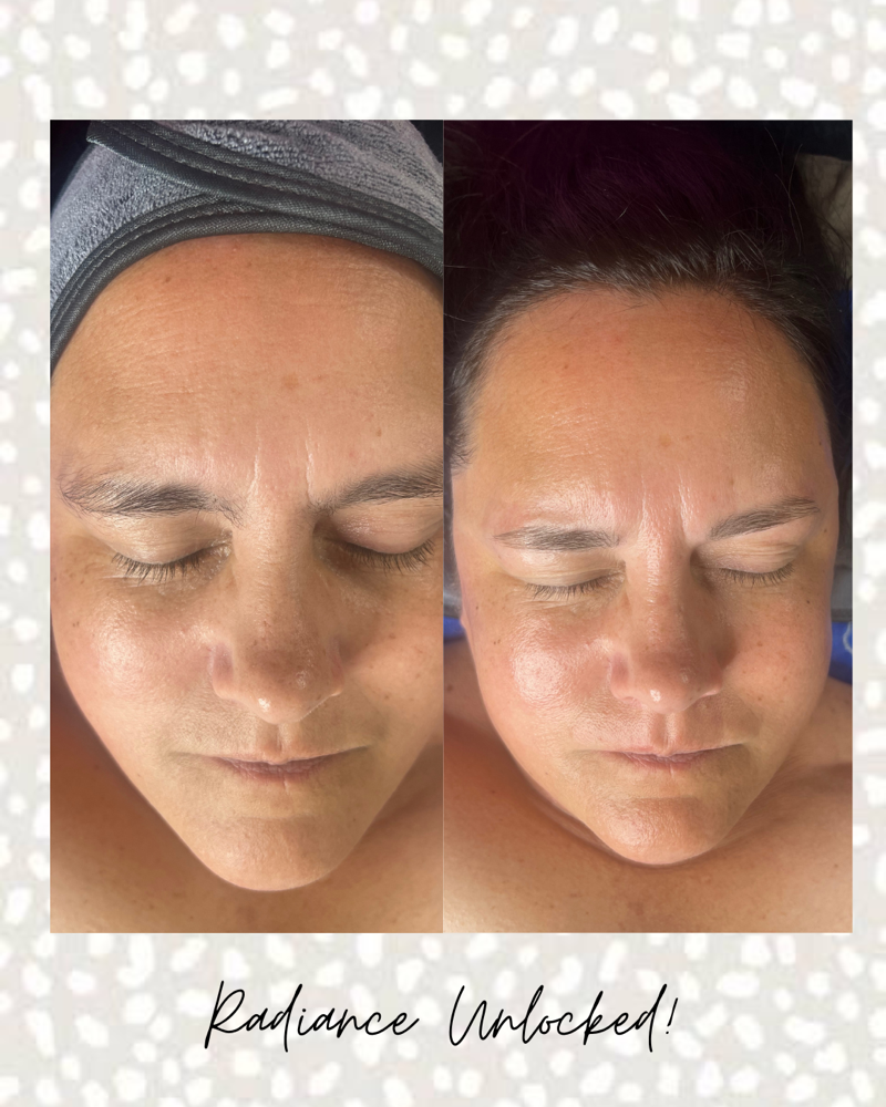 Skin Smoothing Facial