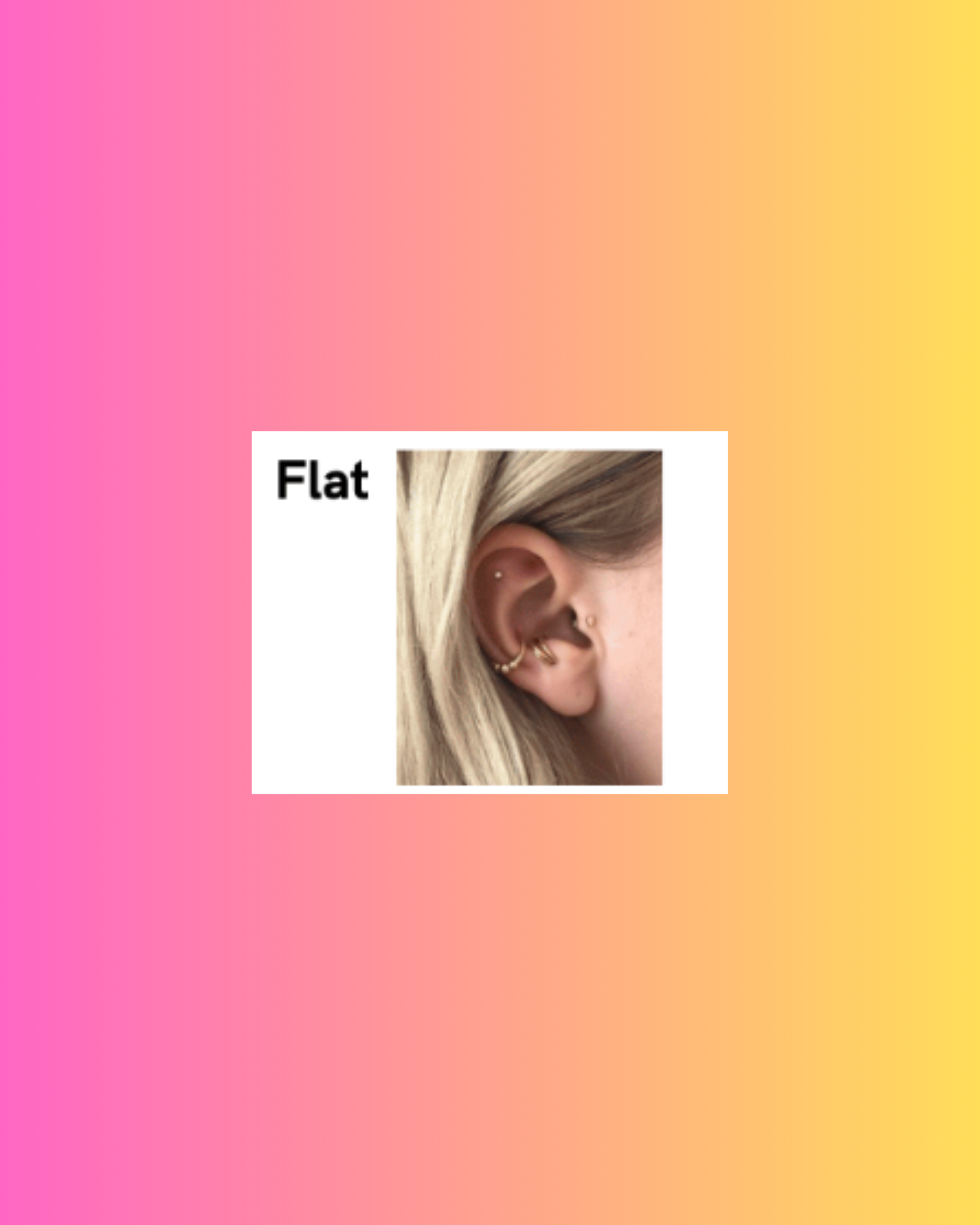 Flat