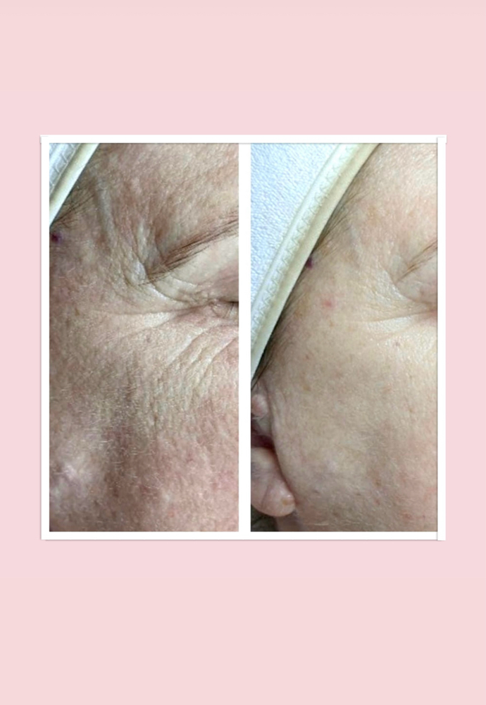 Cellular Energy Infusion Facial