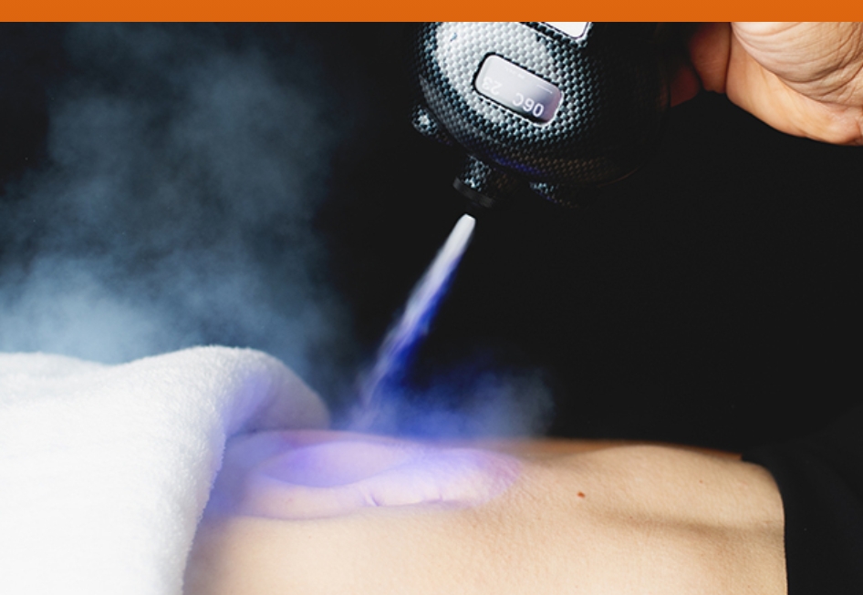 Cryosculpting