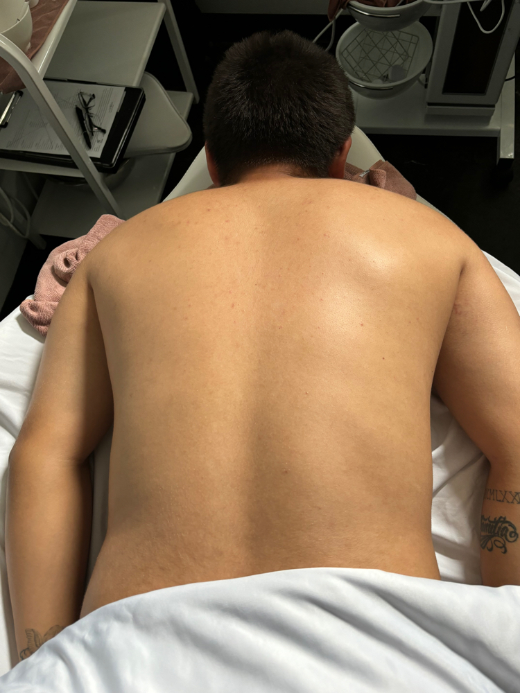 Chest at TheKiss:) in Harrisonburg, VA