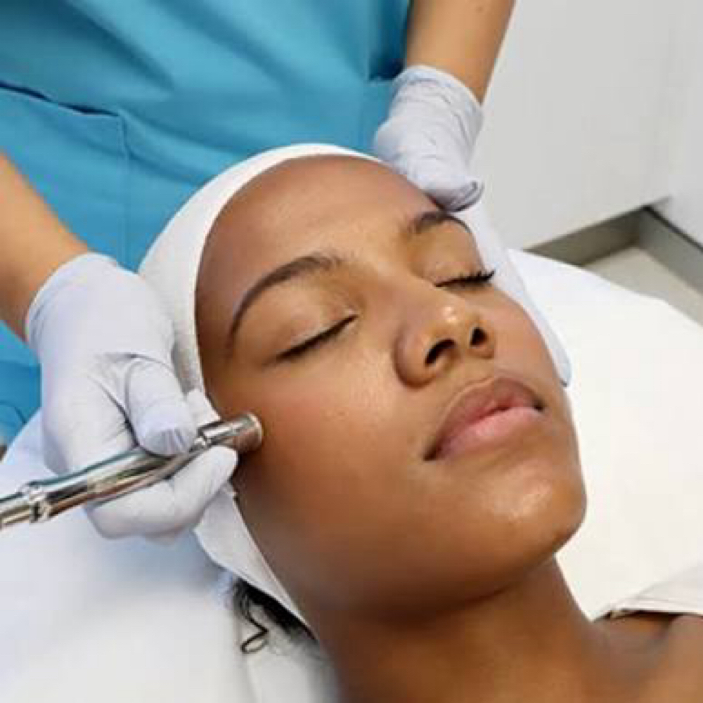 Microdermabrasion Facial at Fine Esthetics Luxury Spa in Memphis, TN