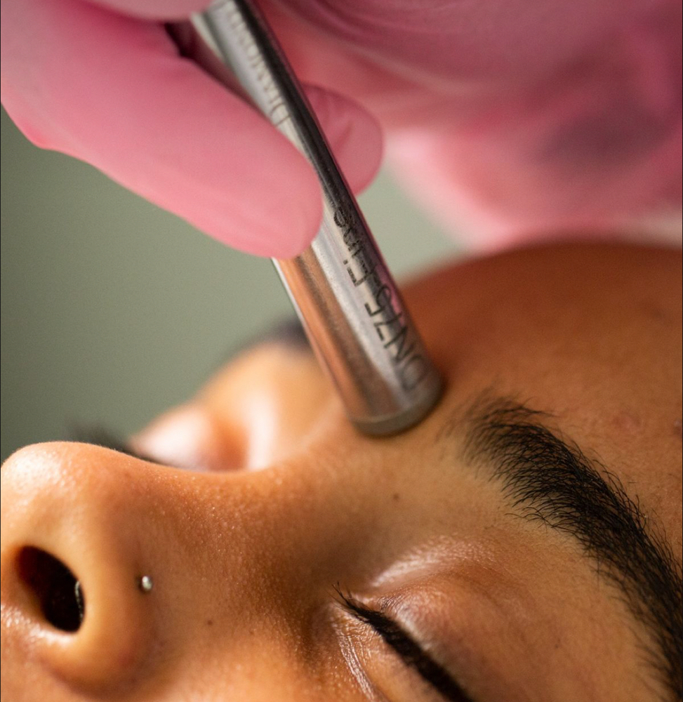 Diamond Microdermabrasion Facial