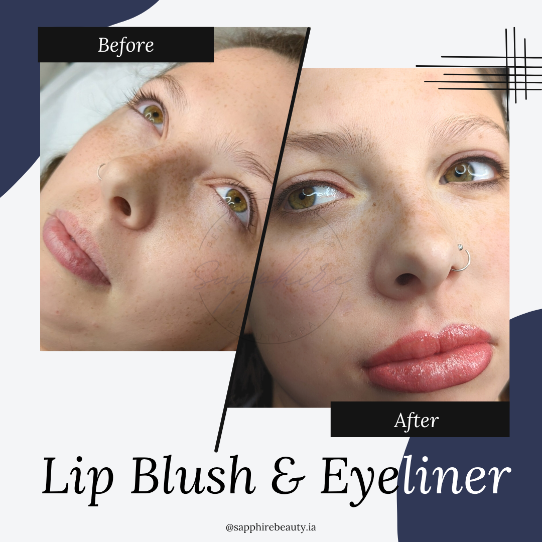 6 week Lip touch up