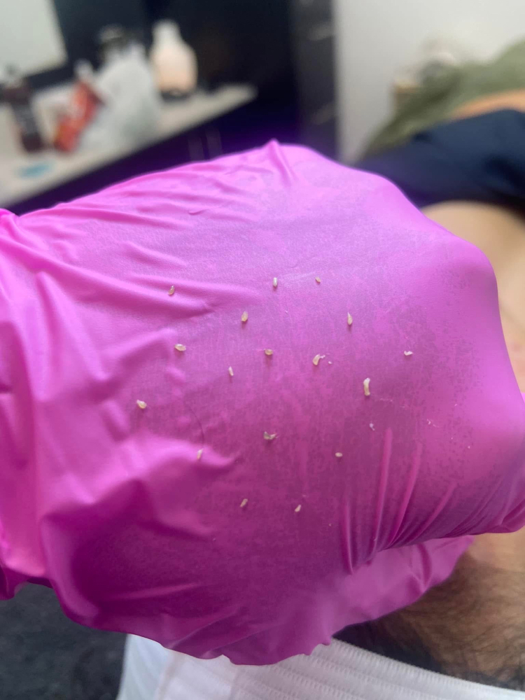Extraction Facial
