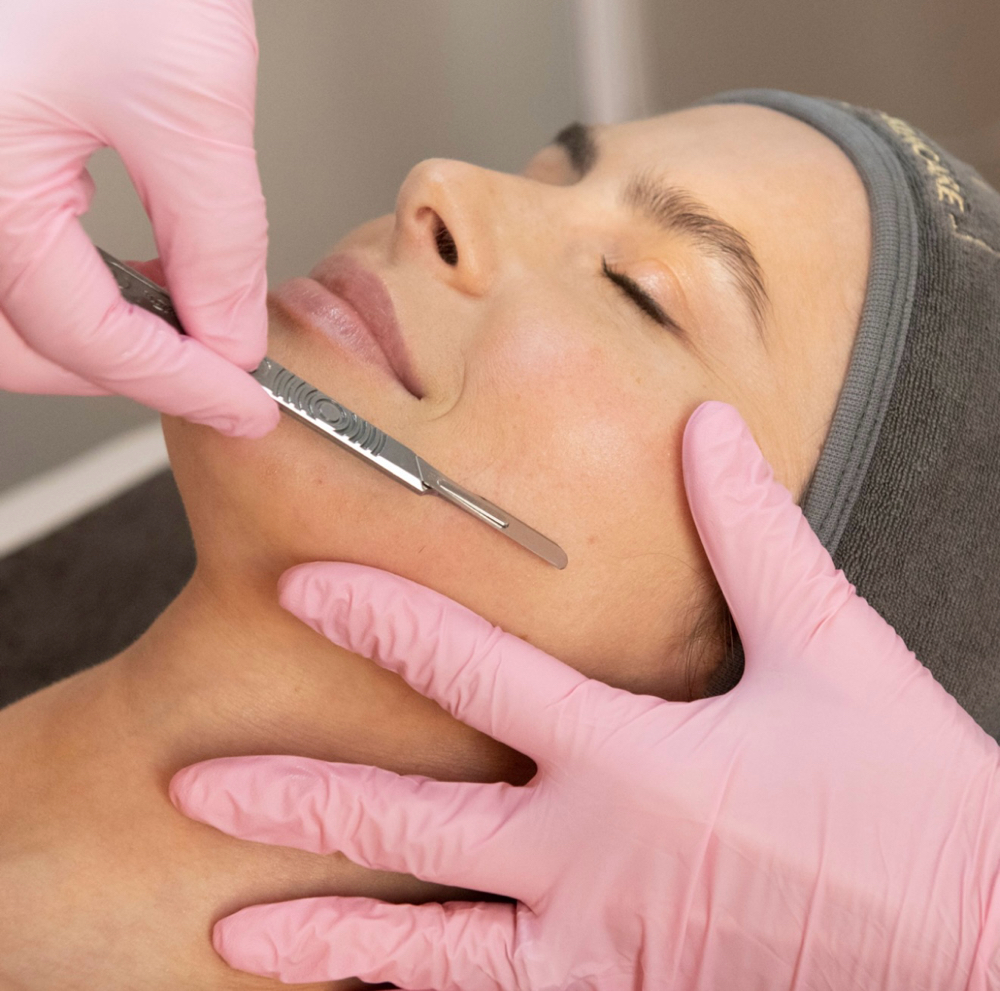 Dermaplane Facial