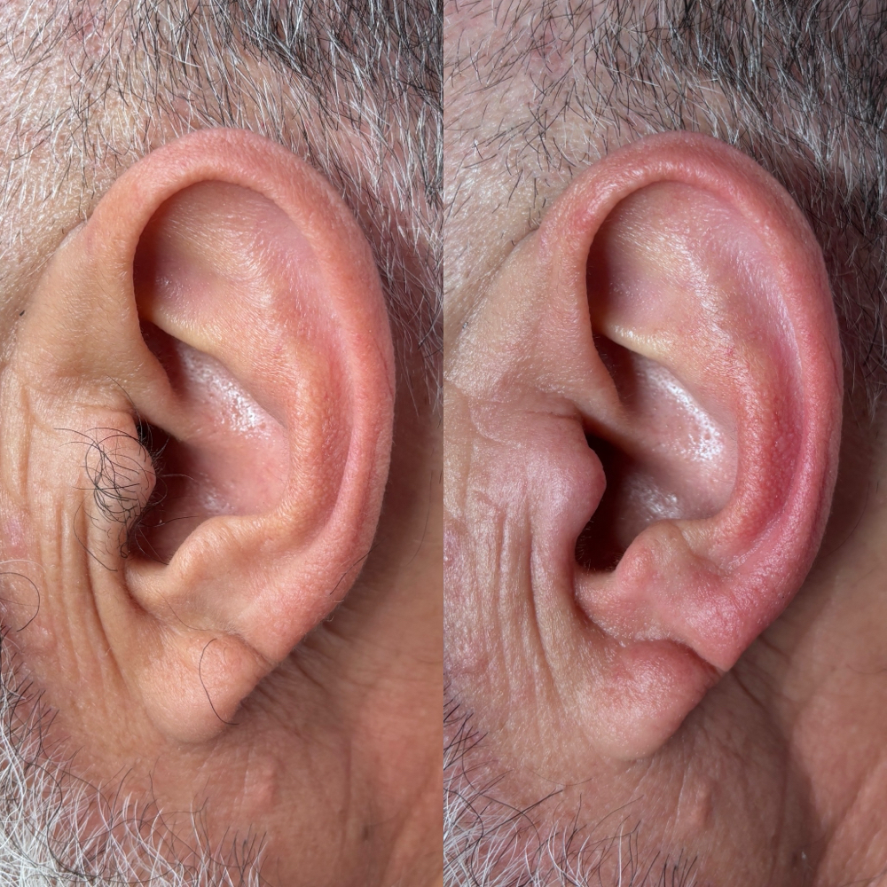 Ears