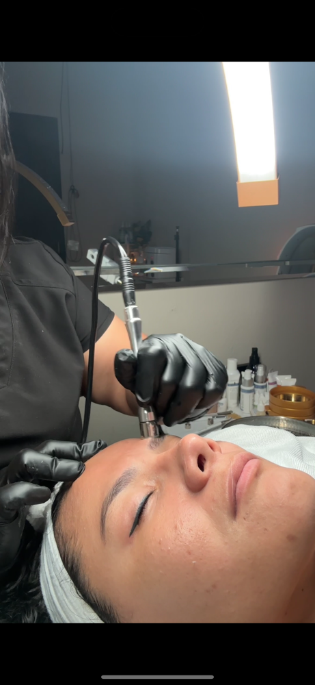Microdermabrasion Treatment at Born Beaute in Mission, TX