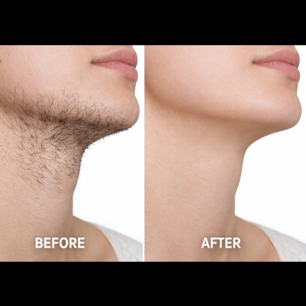 Neck/sideburns/jawline Wax at True Beauty Esthetics in Lufkin, TX