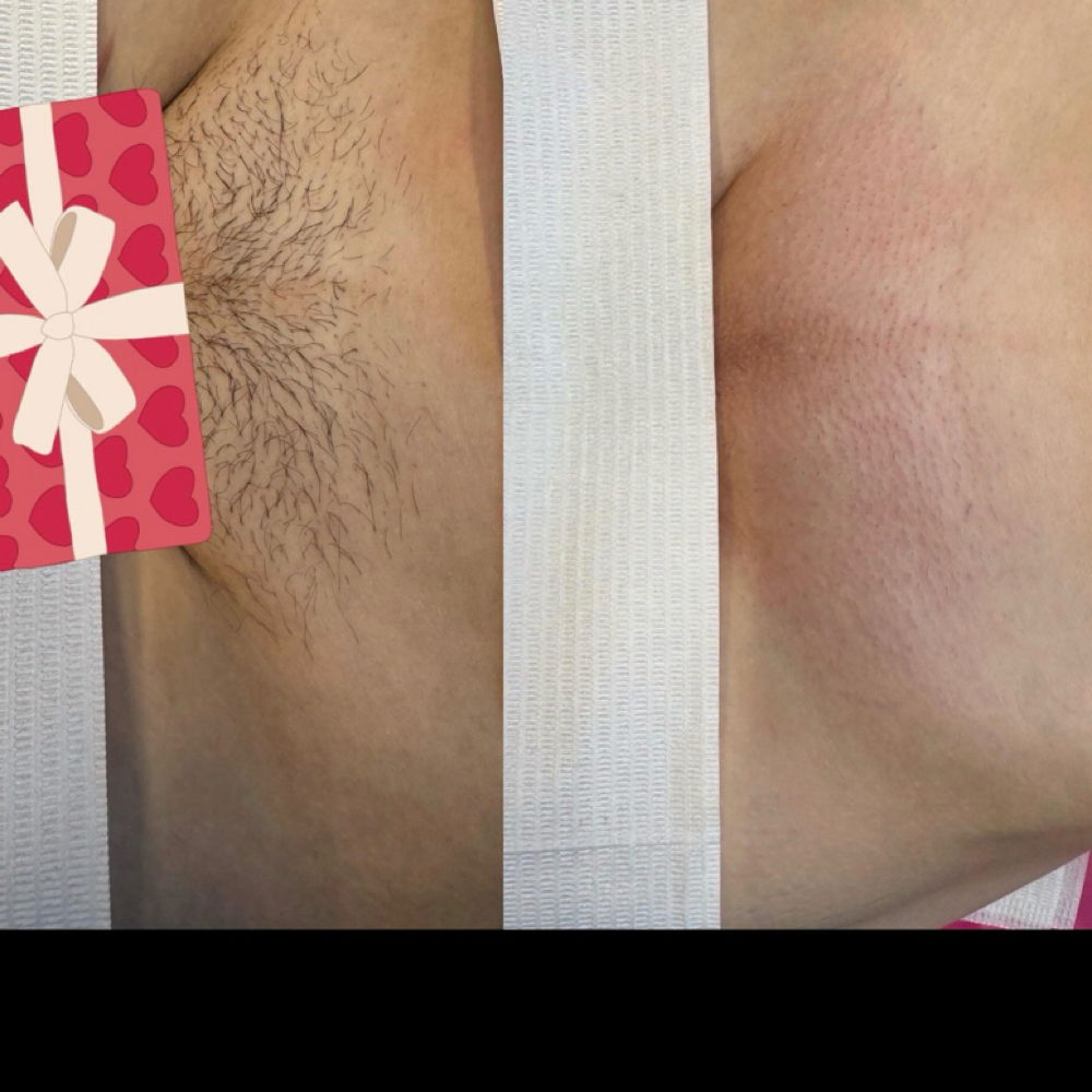 Brazilian Wax at NLoveLash&Brows in Kansas City, MO