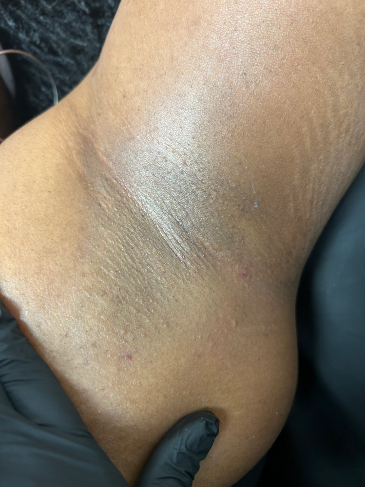 Underarm Wax