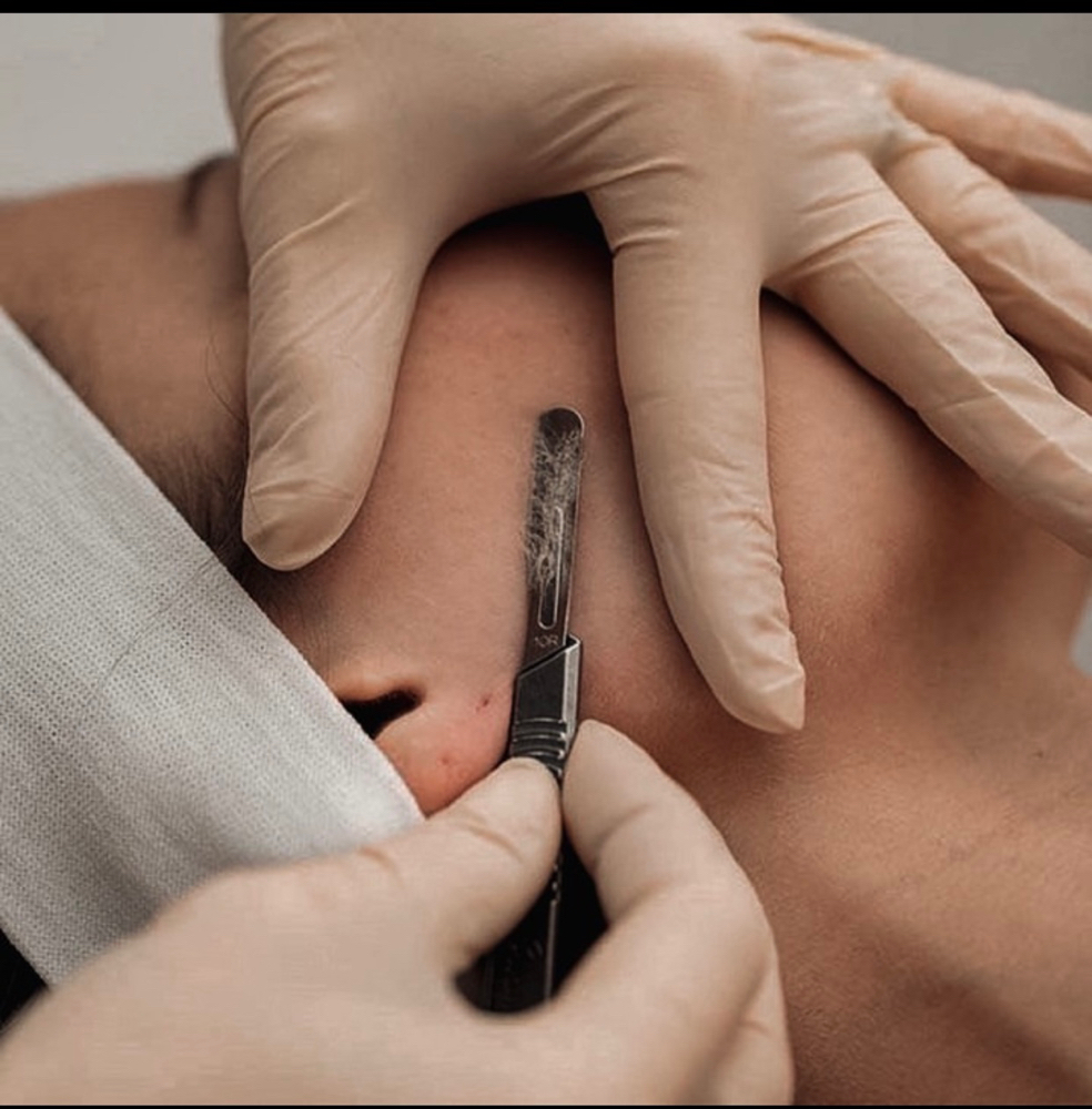 Dermaplan Facial