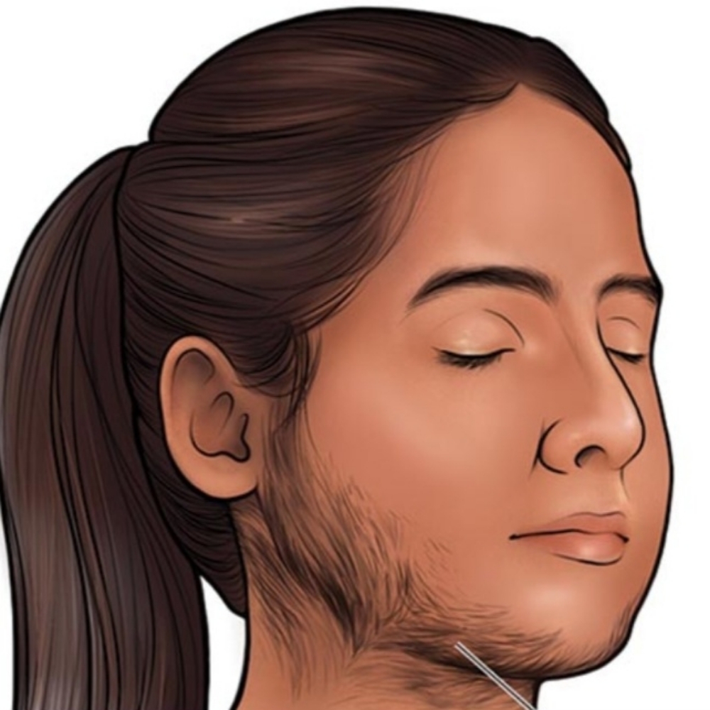 Hirsutism Waxing at FACEZ BY MONICA in Lakewood, CA