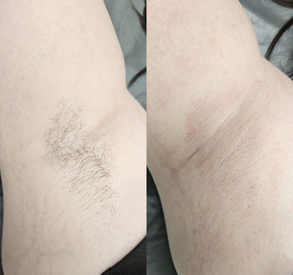 Underarm Wax
