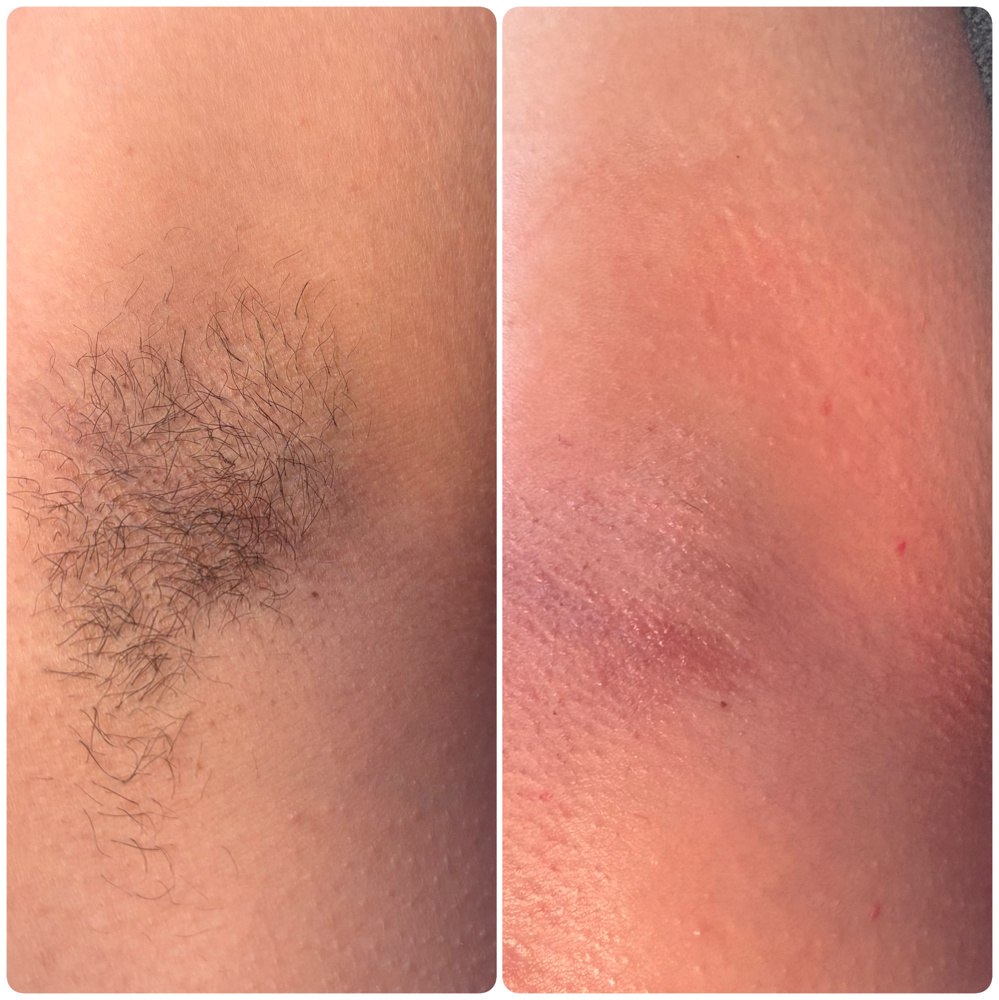 Underarms & Lip Wax Combo