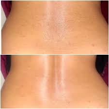 Full Back Wax at BeYou Cosmetics LLC in Columbus, OH