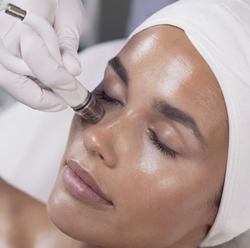 DIAMONDGLOW RESURFACING TREATMENT