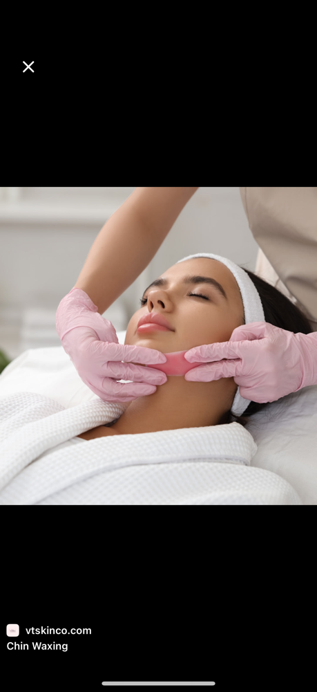 Chin Wax at Taylor Rose Aesthetics in Altoona, WI