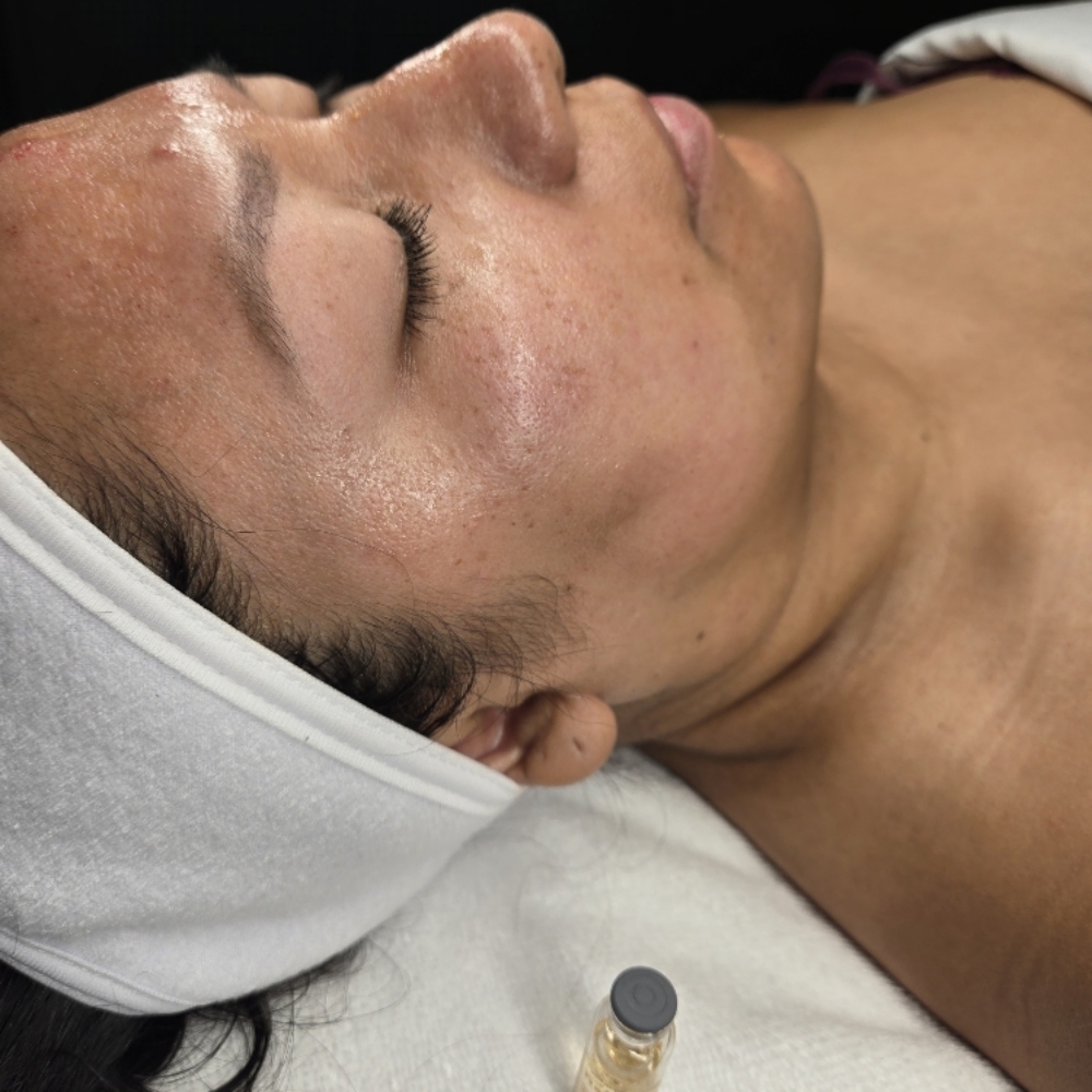 Nano Infusion facial at Midtown Esthetics in Raleigh, NC