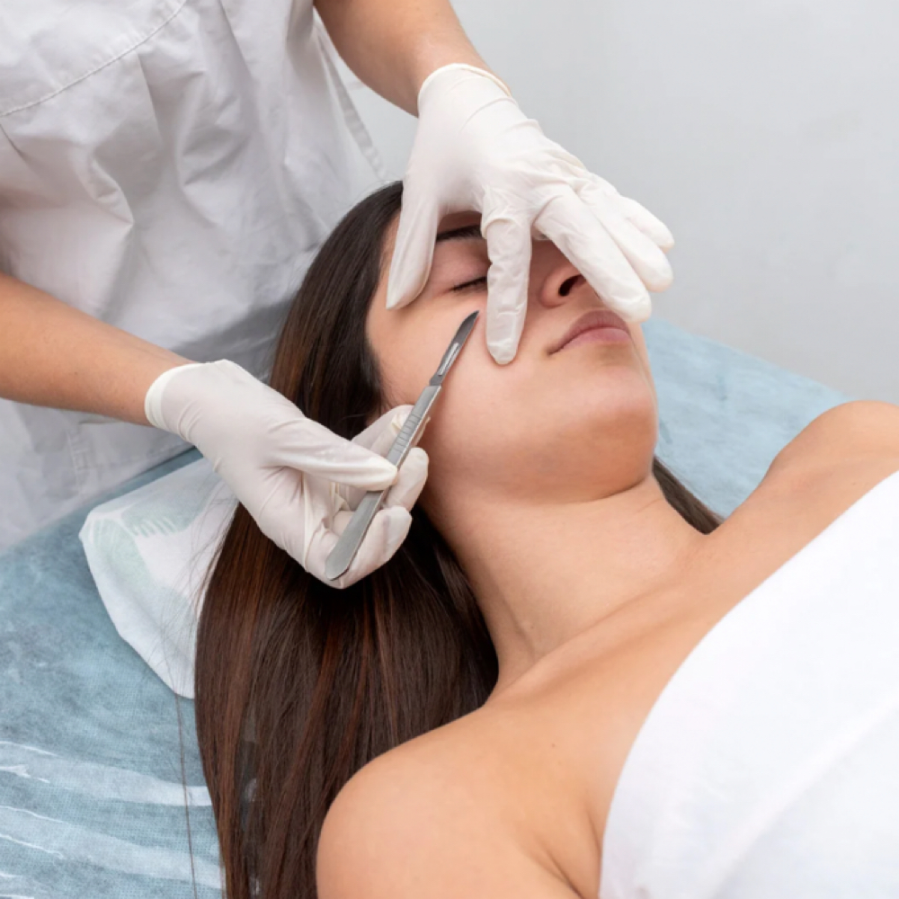 Dermaplaning Add On at Blessed Beauty in Shreveport, LA