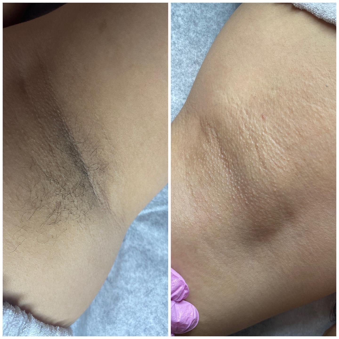 Body Waxing